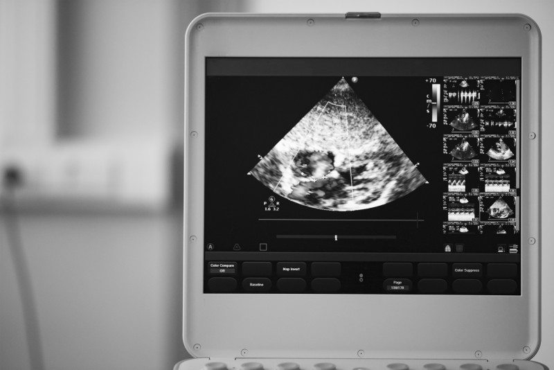 Reasons Why Your Medical Practice Requires a Portable Ultrasound Machine
