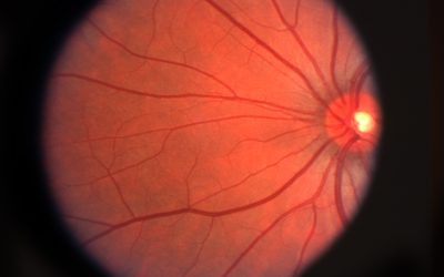 Learn How Treatment Options for Macular Degeneration, Ohio Residents Trust Can Help