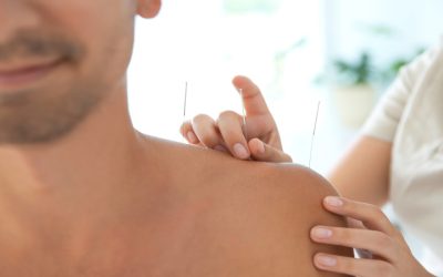 Managing Chronic Pain Naturally with Acupuncture Therapy Sudden Valley, WA Solutions