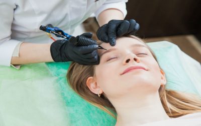 Real Results Patients See With Microneedling in Kalispell, MT, for Acne Scarring